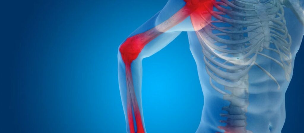 Τεστ οστικής πυκνότητας: Σε ποια ηλικία πρέπει να το κάνετε  - Media