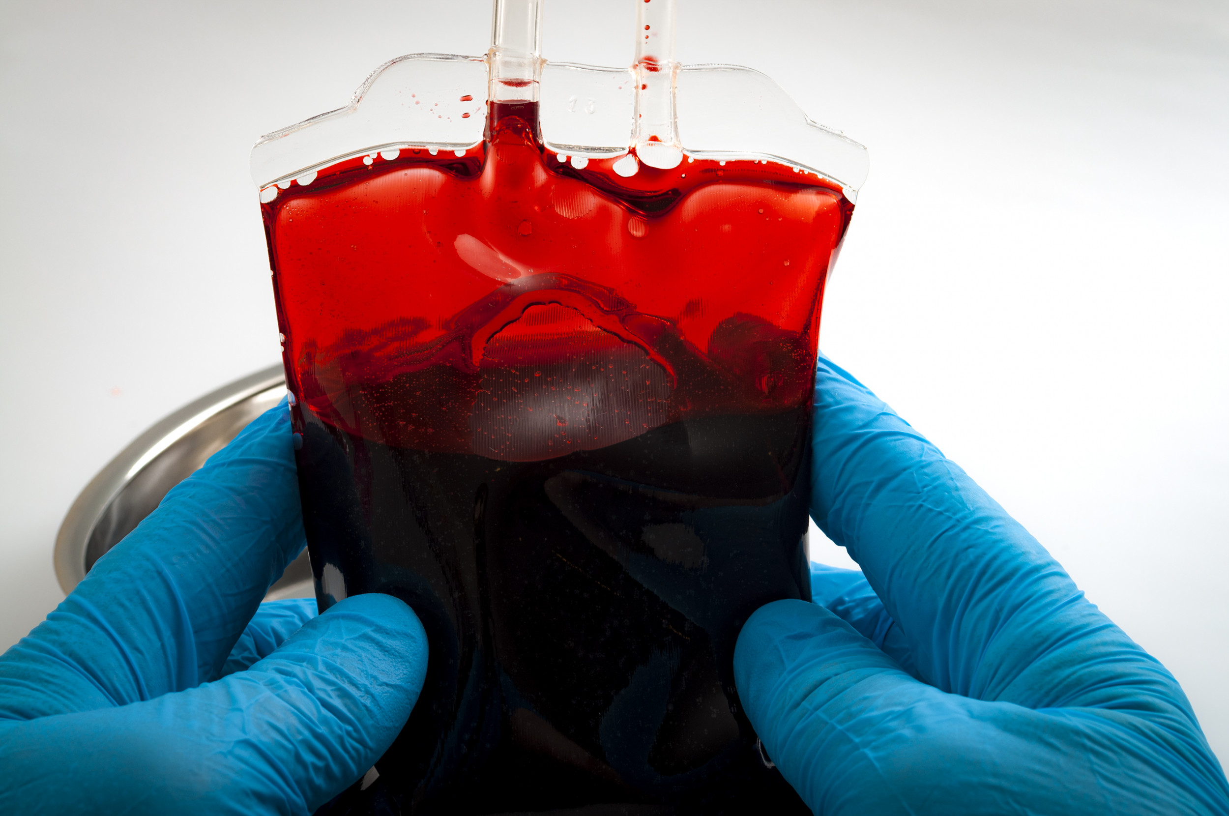Κορωνοϊός: Ποια ομάδα αίματος κινδυνεύει περισσότερο να νοσήσει σοβαρά - Media