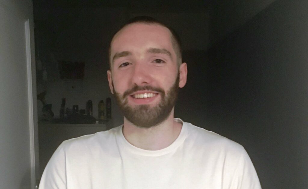 Ισπανία: Πικρό τέλος για έναν 27χρονο - Πέθανε αφού τον δάγκωσε ένα από τα 25 κατοικίδια φίδια του - Media