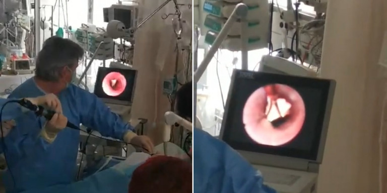 Πάτρα: Βρέφος 10 μηνών κατάπιε καρύδι - Αγωνία για τη σωτηρία του (Video) - Media