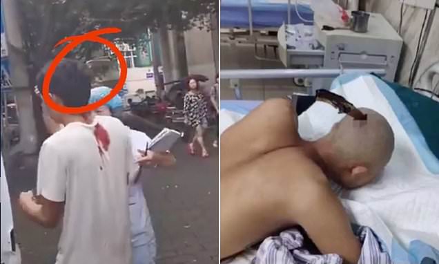 Του κάρφωσαν ένα μαχαίρι βαθιά στο κρανίο και όμως εκείνος περπάτησε μέχρι το ασθενοφόρο (Video) - Media