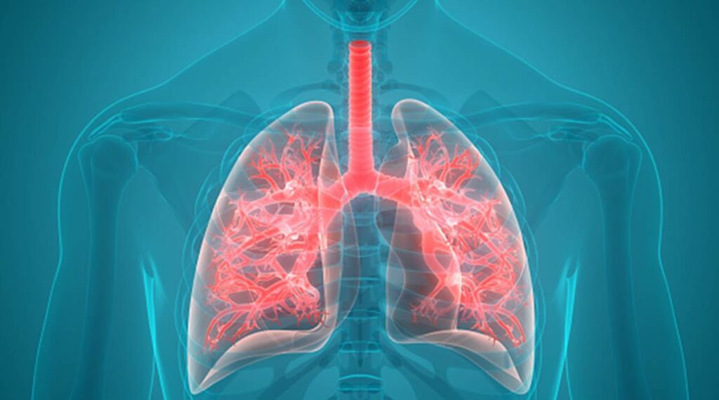 Μικροκυτταρικός καρκίνος του πνεύμονα: Τα «ύπουλα» συμπτώματα του πολύ επιθετικού καρκίνου - Media