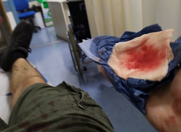 «Λένε, δεν γίνονται αυτά στα καλά καθούμενα – Και όμως, γίνονται»: Μαρτυρία σοκ από την επιδρομή της ΔΡΑΣΗ στα Εξάρχεια - Media