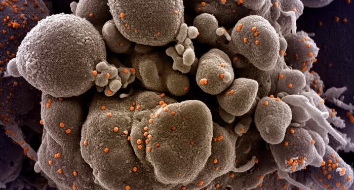 Τι σημαίνει δεύτερο κύμα κoρωνοϊού - Συναγερμός για την εξάπλωση των κρουσμάτων - Media