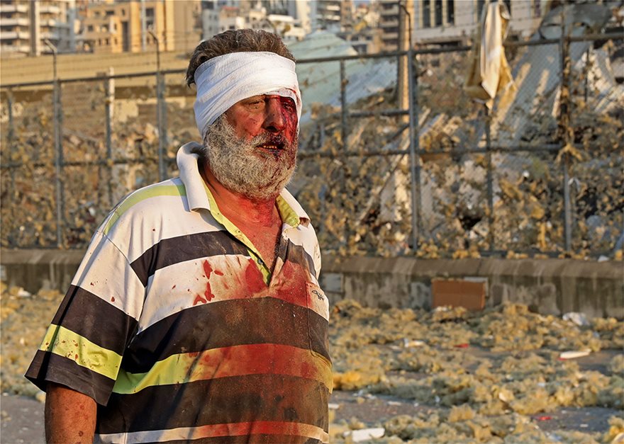 Βηρυτός: Οι πρώτες υποψίες για την αιτία της έκρηξης - Media