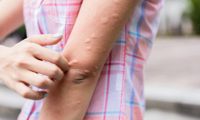 Πέντε μυστικά για να μην σε τσιμπάνε τα κουνούπια - Media