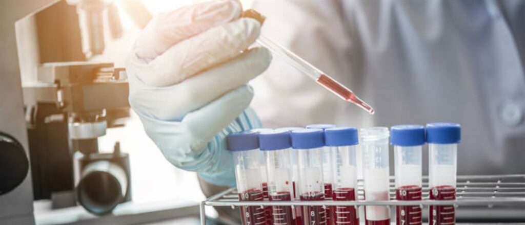 Η αλήθεια για τη θεραπεία με πλάσμα αίματος - Media