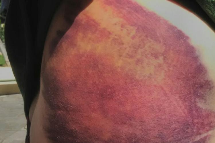 Θεσσαλονίκη: Φωτογραφία-ντοκουμέντο από τον άγριο ξυλοδαρμό συλληφθέντος από ΜΑΤ και ΔΡΑΣΗ - Media