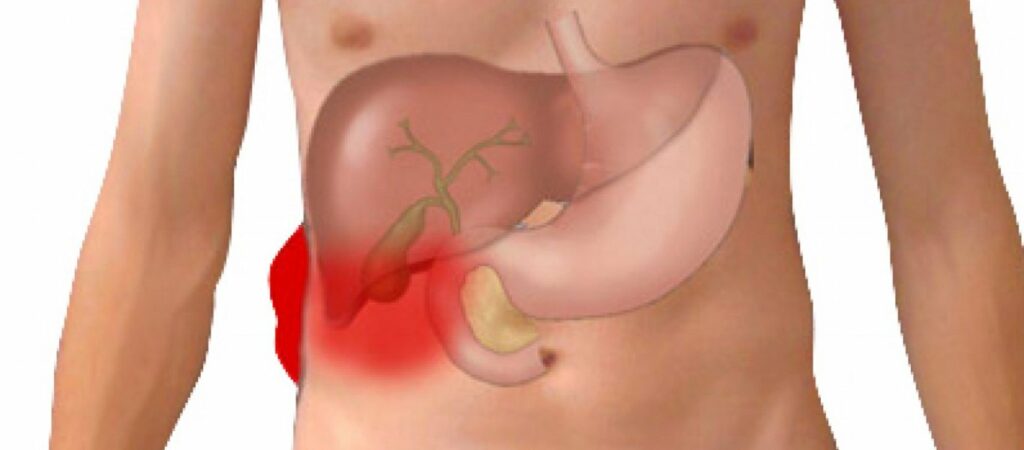 Η δίαιτα - έκπληξη που μειώνει κατά 40% το λίπος στο ήπαρ - Media