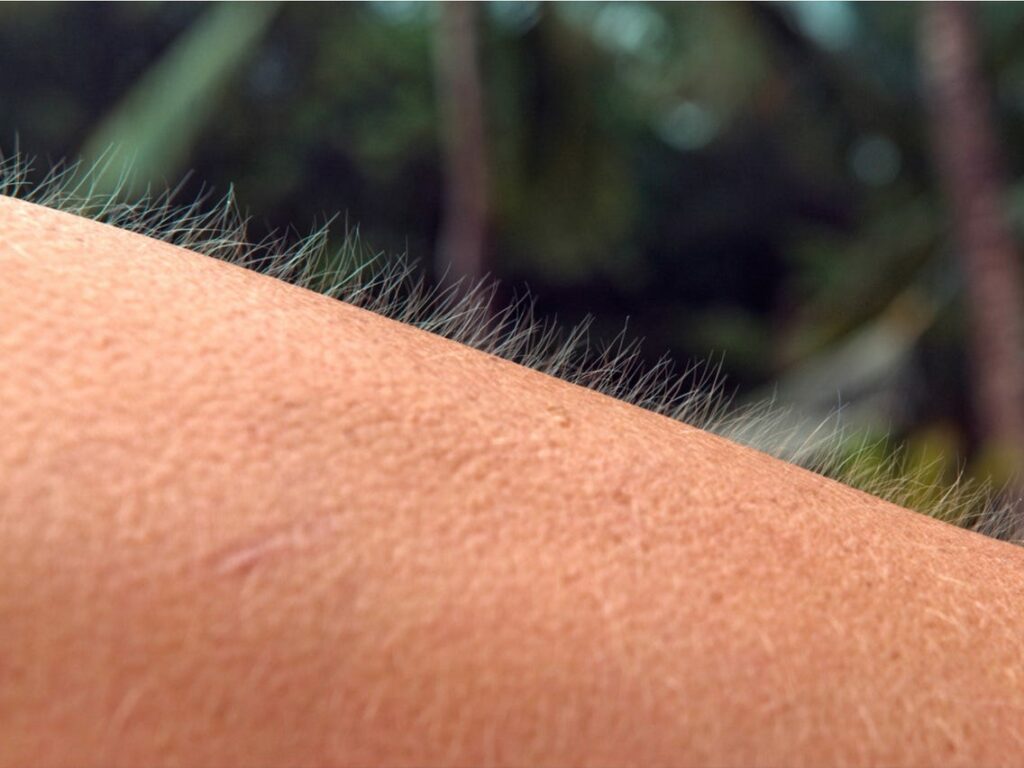 Ανατριχίλα: Τι είναι και γιατί συμβαίνει - Media