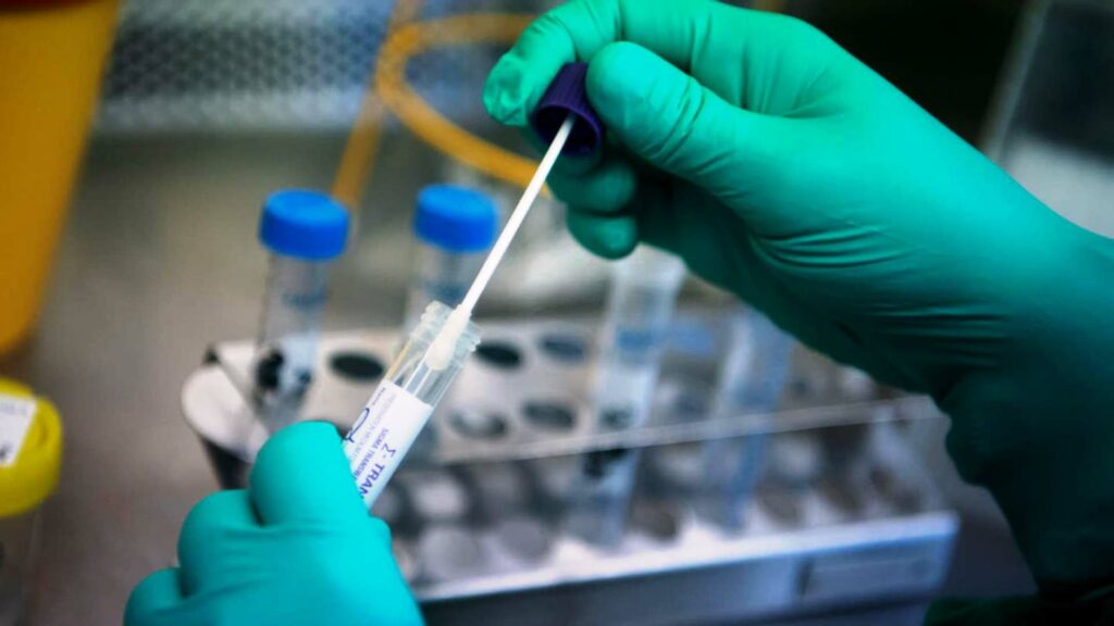 ΗΠΑ: Πράσινο φως για τεστ που ξεχωρίζει την Covid-19 από τη γρίπη Α και Β - Media