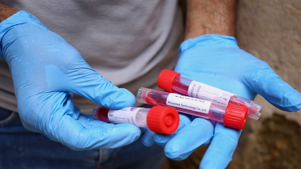 Κορωνοϊός: Ξανά θετικός μετά από τέσσερις μήνες ένας 45χρονος - Media