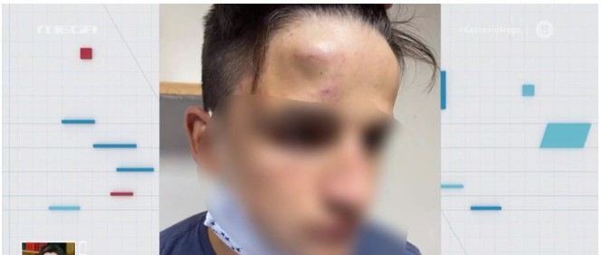 Συμμορία ανηλίκων ξυλοκόπησε άγρια 17χρονο στο Γαλάτσι (Video) - Media