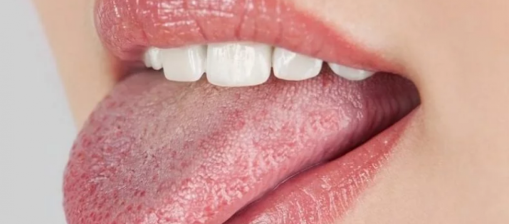 Τι αποκαλύπτει η γλώσσα σας για την υγεία σας - Τα σημάδια που πρέπει να σας ανησυχήσουν  - Media