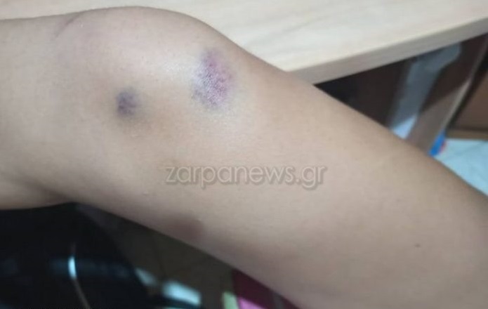 Χανιά: Μαθητές τραυματίστηκαν σε λεωφορείο του ΚΤΕΛ στα Χανιά – Έξαλλος ο οδηγός έσυρε απότομα το χειρόφρενο (Photos) - Media