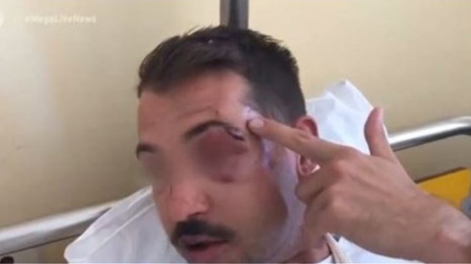 Άγριος ξυλοδαρμός για ένα κινητό στο Γκάζι - Βίντεο από το νοσοκομείο - Media