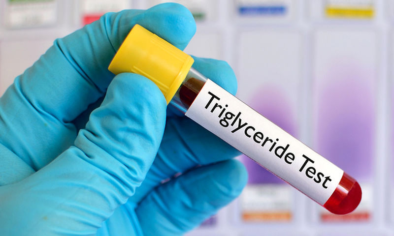 Τριγλυκερίδια: Δέκα αποτελεσματικοί τρόποι να τα μειώσετε χωρίς φάρμακα - Media