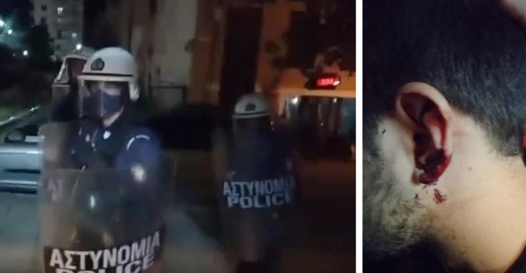 Πάτρα: Καταγγελία για αστυνομική βία με επίθεση και σε δημοσιογράφο - Media