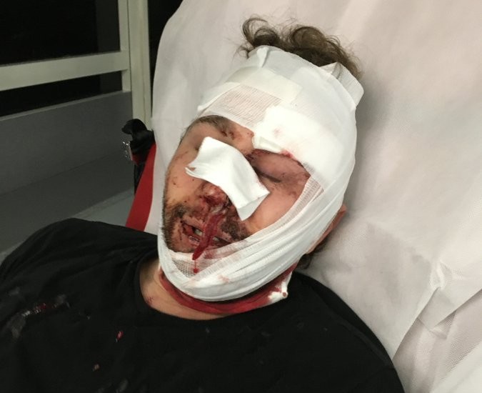 Άγριο ξύλο από τα γαλλικά ΜΑΤ σε Σύριο φωτορεπόρτερ του AFP – Τον έστειλαν αιμόφυρτο στο νοσοκομείο (Photos) - Media