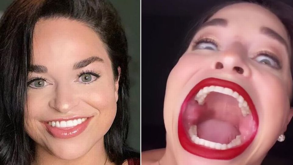 ΗΠΑ: 30χρονη έγινε γνωστή για το… τεράστιο στόμα της (Photos/Video) - Media