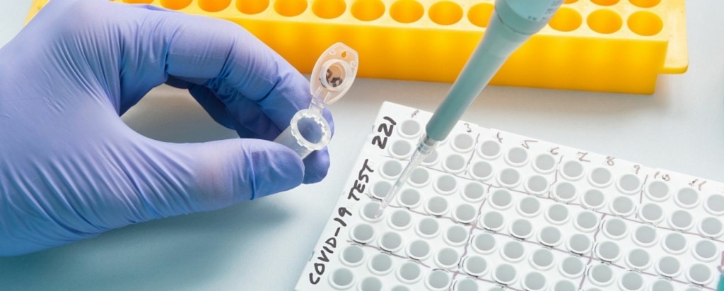 Polymerase Chain Reaction_new