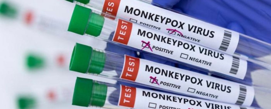 Monkeypox Virus_new
