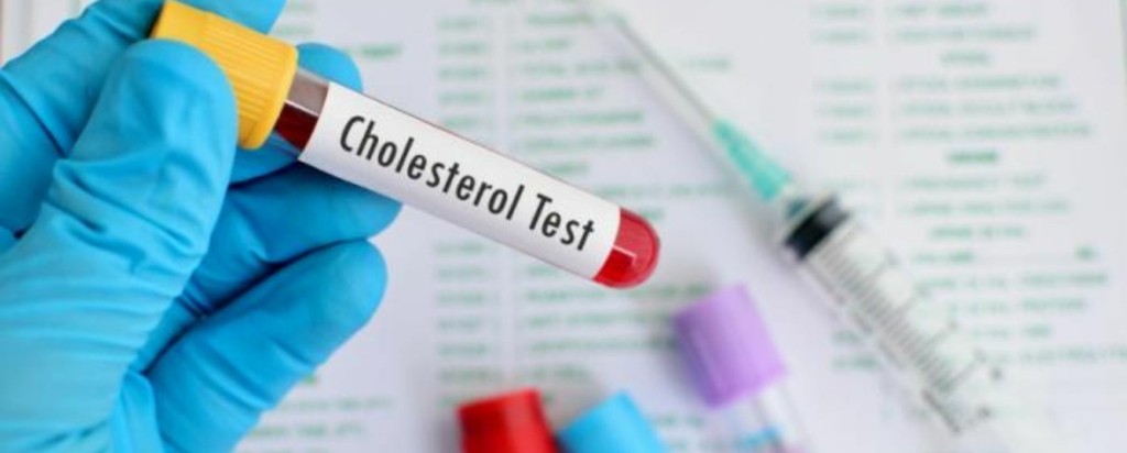 LDL Cholesterol_new