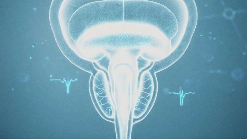 KARKINOS-PROSTATIS-NEW