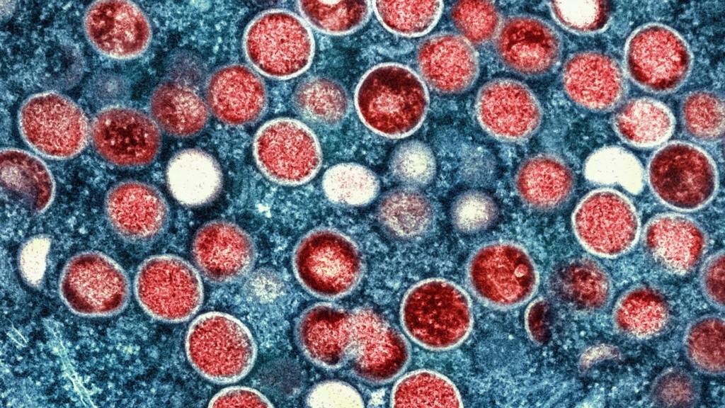 mpox