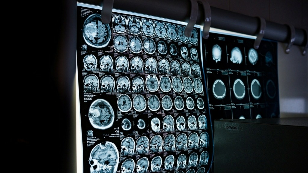 cat_scan_new