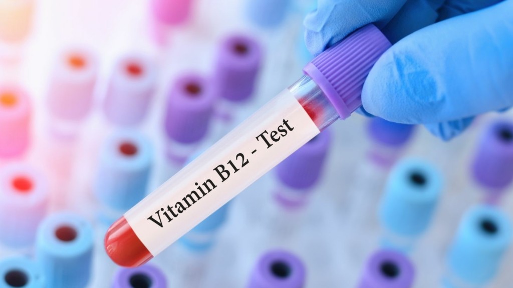 vitamini_b12