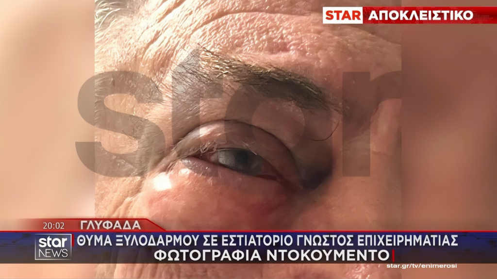 glifada_xilo