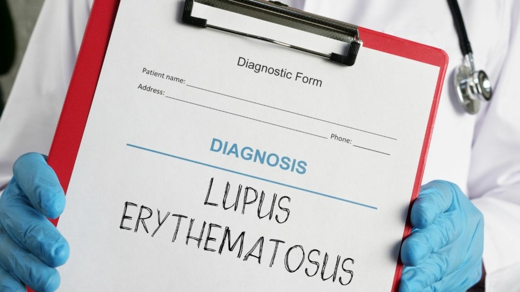 systemic_lupus_erythematosus_new