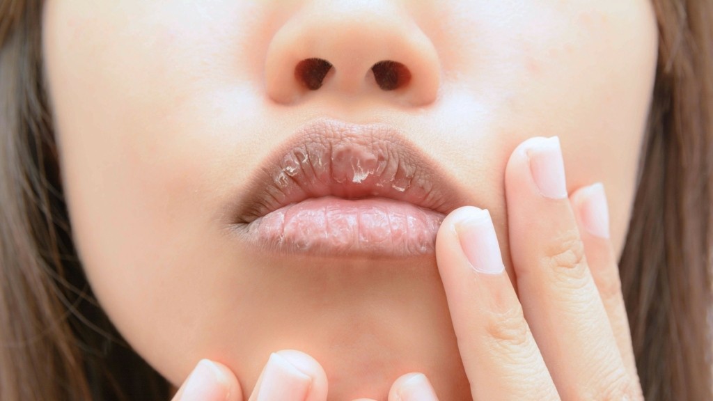 dry-lips_0310_`1920-1080_new