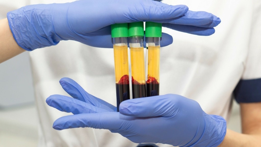 blood_plasma_1011_1920-1080_new