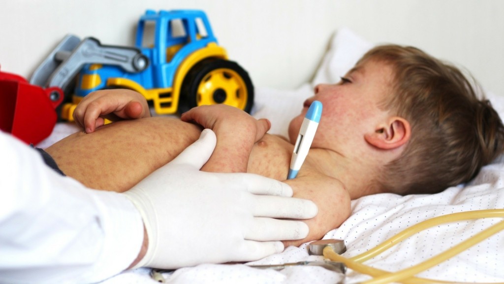 measles_ilara_2811_1920-1080_new