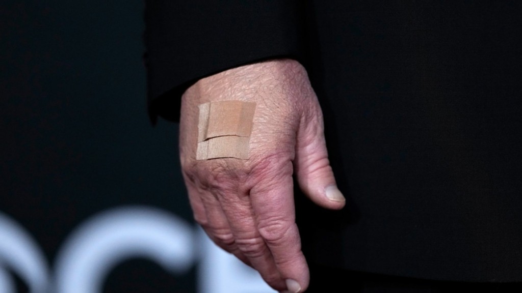 trump xeri tsiroto 88- new