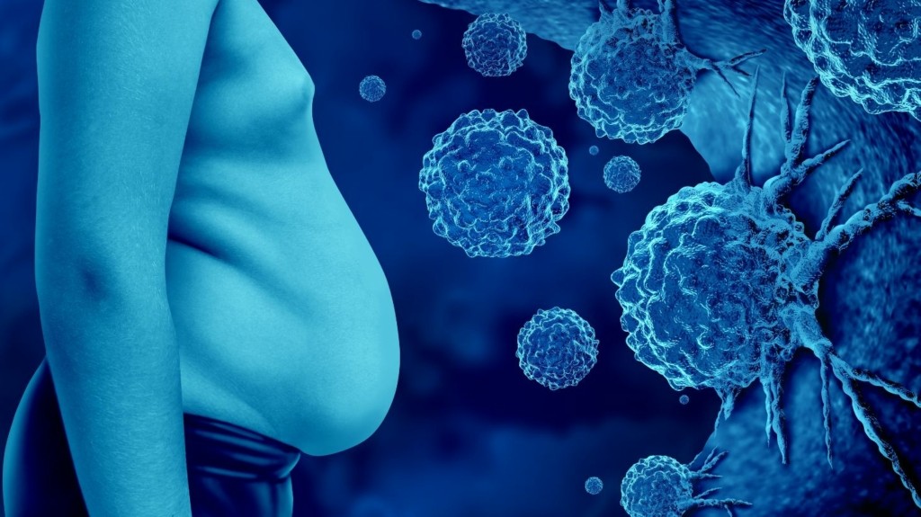 obesity_cancer_new