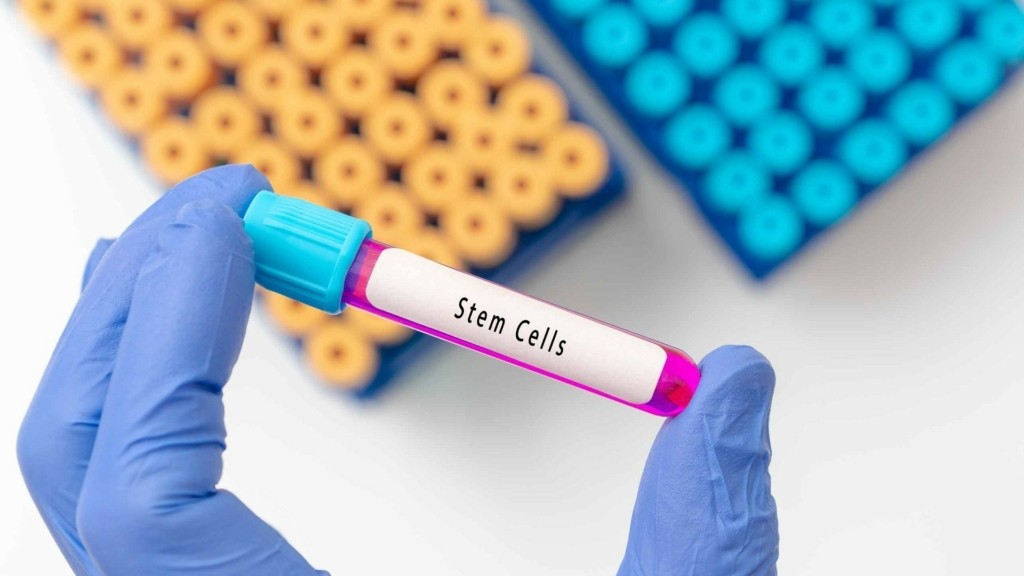 stem-cells_parkinson_1601_1920-1080_new