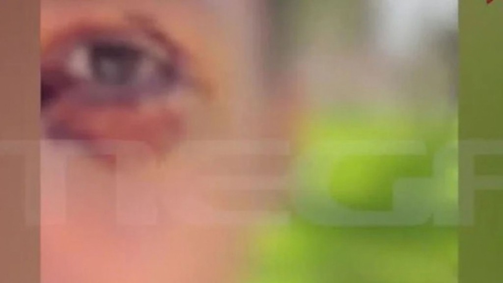 MATI_IOANNINA_XYLODARMOS