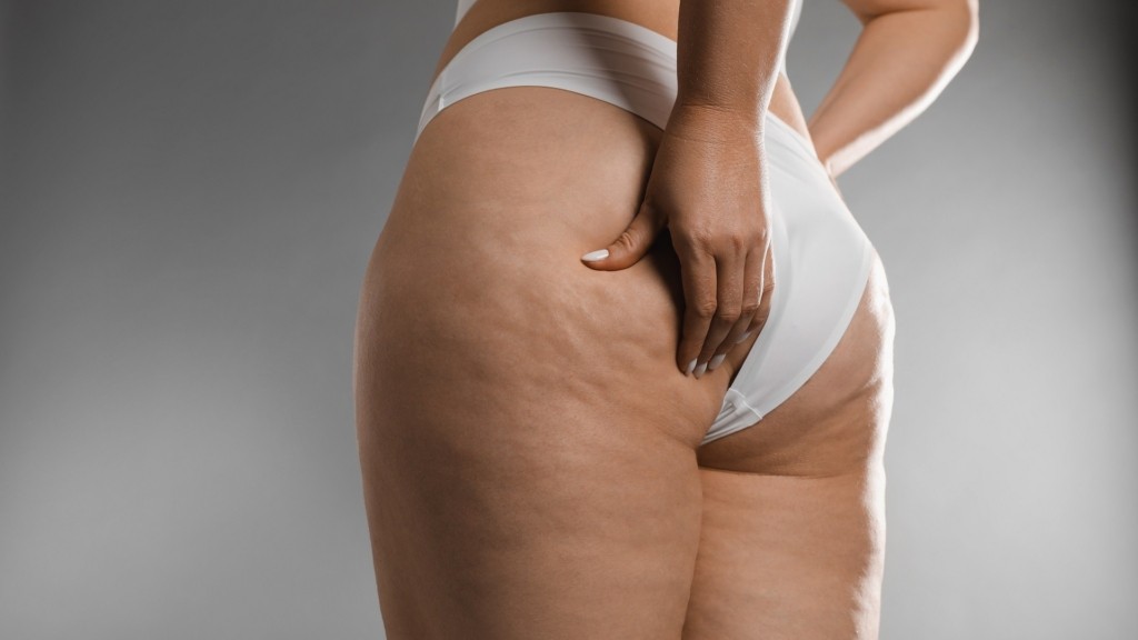 cellulite_kittaritida_2904_1920-1080_new