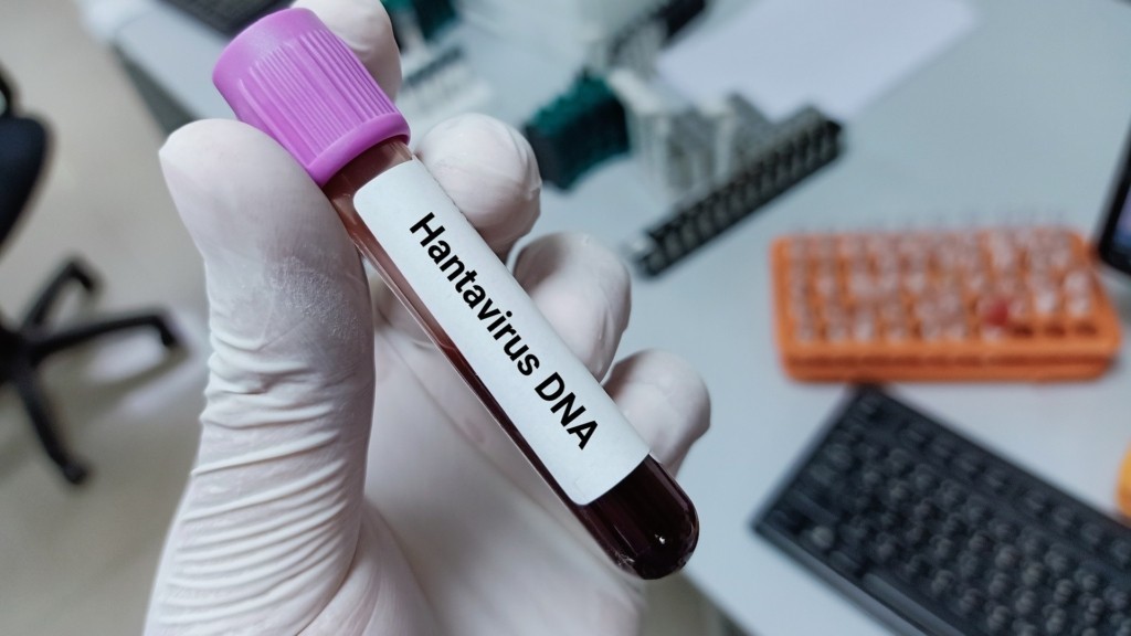 hantavirus