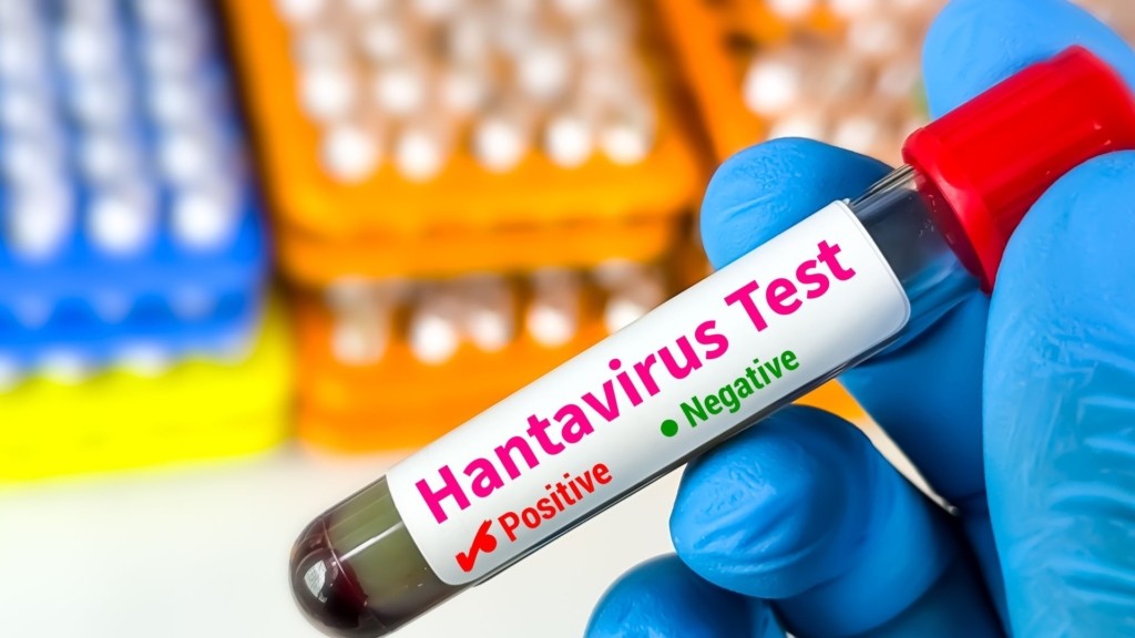 hantavirus_test