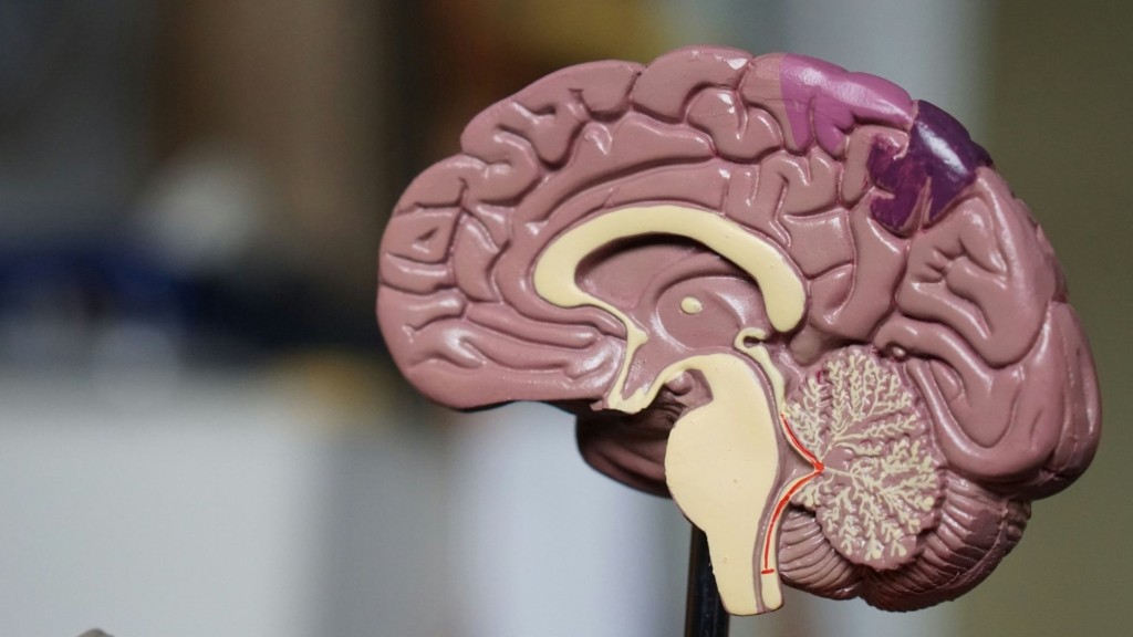 aneurysm_brain