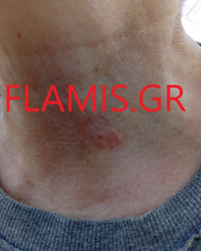 flamis