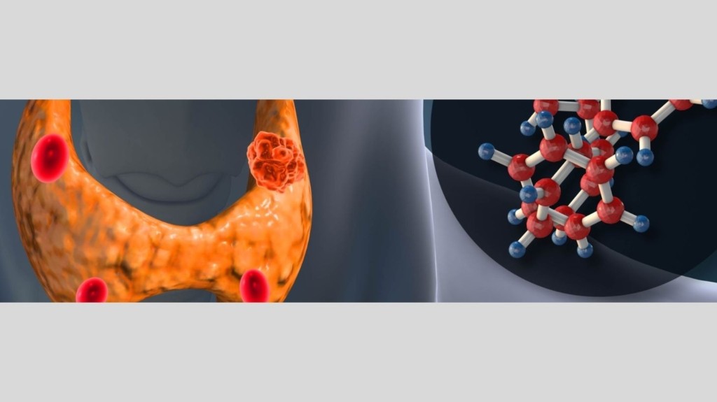 primary_hyperparathyroidism_new